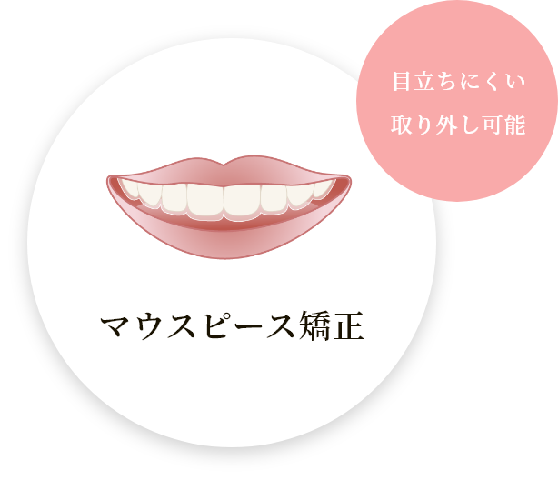 マウスピース矯正